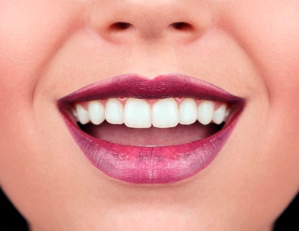 Beneficios del blanqueamiento dental