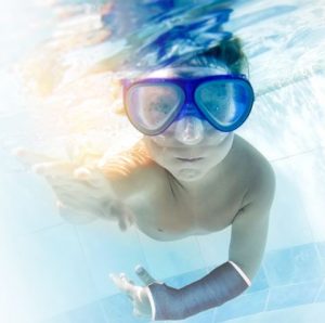 ¿Verano y con escayola? ¡Eso ya no es problema!