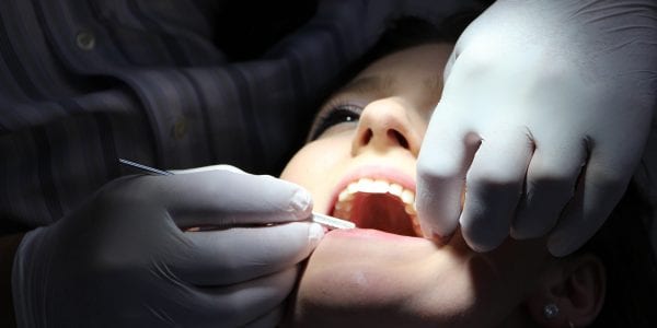 Implantes dentales clínica dental