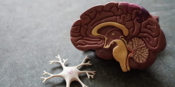 recuperación ictus cerebral