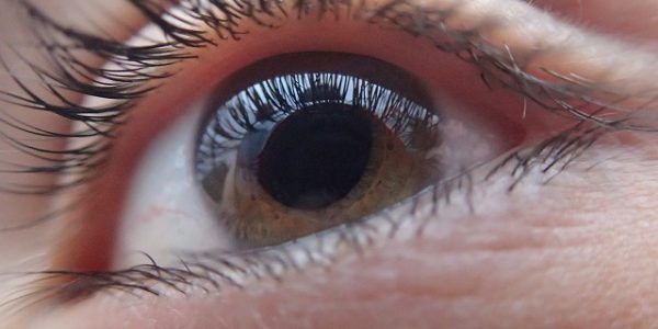glaucoma