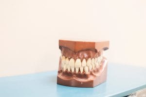 Falsos mitos de la implantología oral