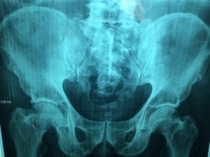 Cómo hacer que los pacientes queden satisfechos con un TAC en Sevilla
