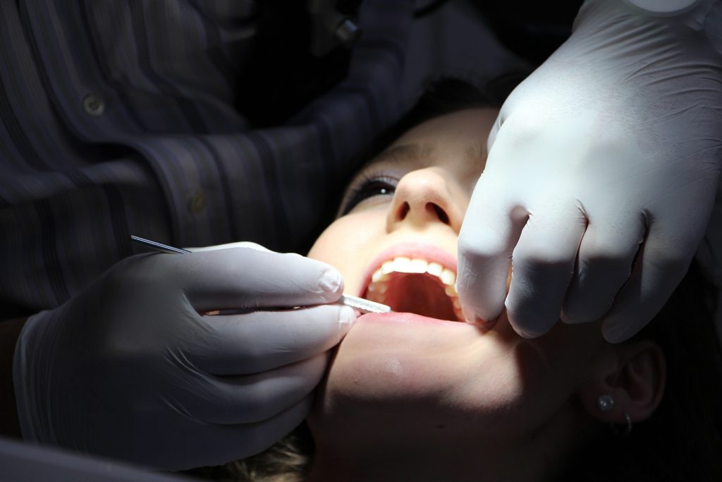 Implantes dentales clínica dental