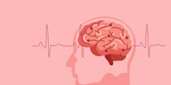 daño cerebral ilustración.